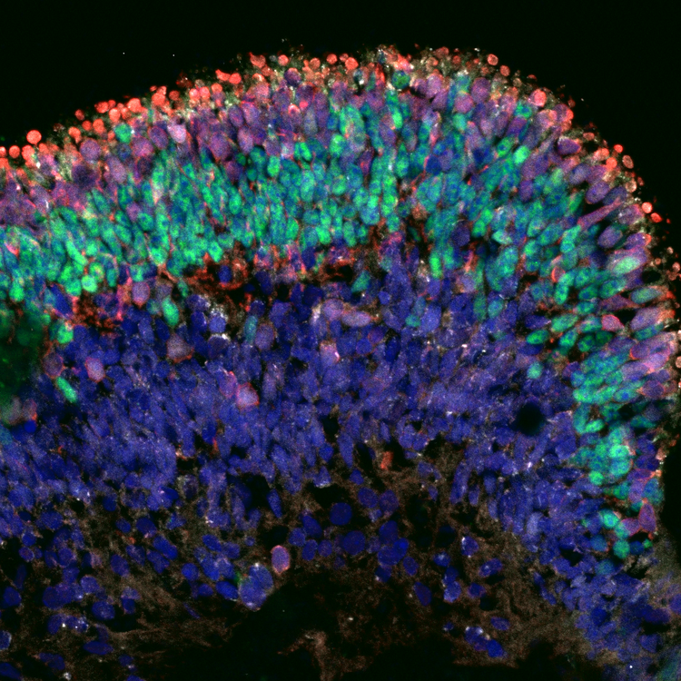 'Rod cells in the retina of the ‘mini eyes’