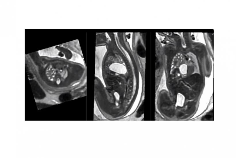 image of MRI scan