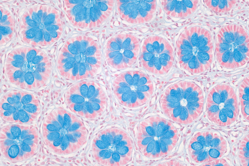 Blooming Barrier